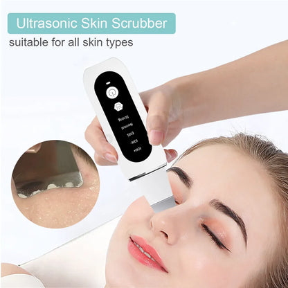 Ultrasonic Skin Scrubber Peeling Blackhead Remover Deep Face Cleaning Ultrasonic Ion Ance Pore Cleaner Facial Shovel Cleanser