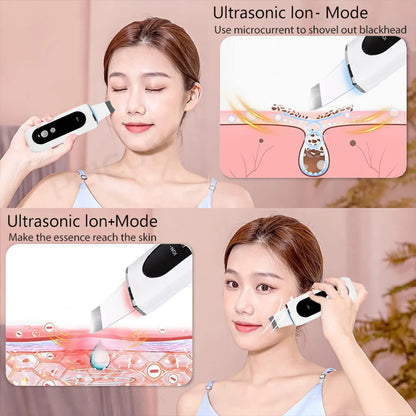 Ultrasonic Skin Scrubber Peeling Blackhead Remover Deep Face Cleaning Ultrasonic Ion Ance Pore Cleaner Facial Shovel Cleanser